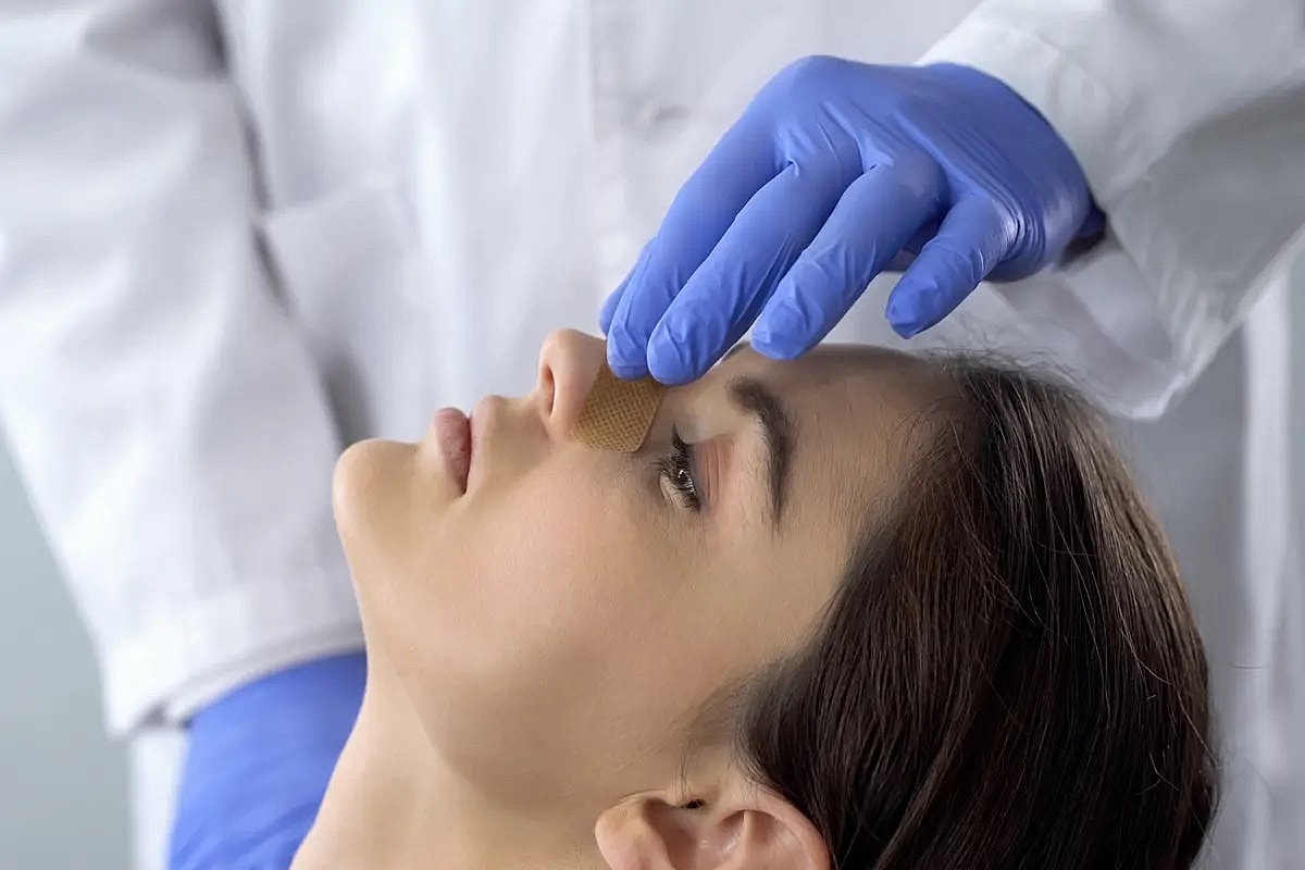 What to Do Before and After Rhinoplasty Surgery