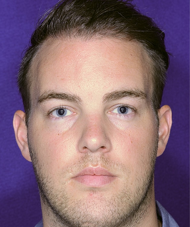 Man with short hair and blue eyes.