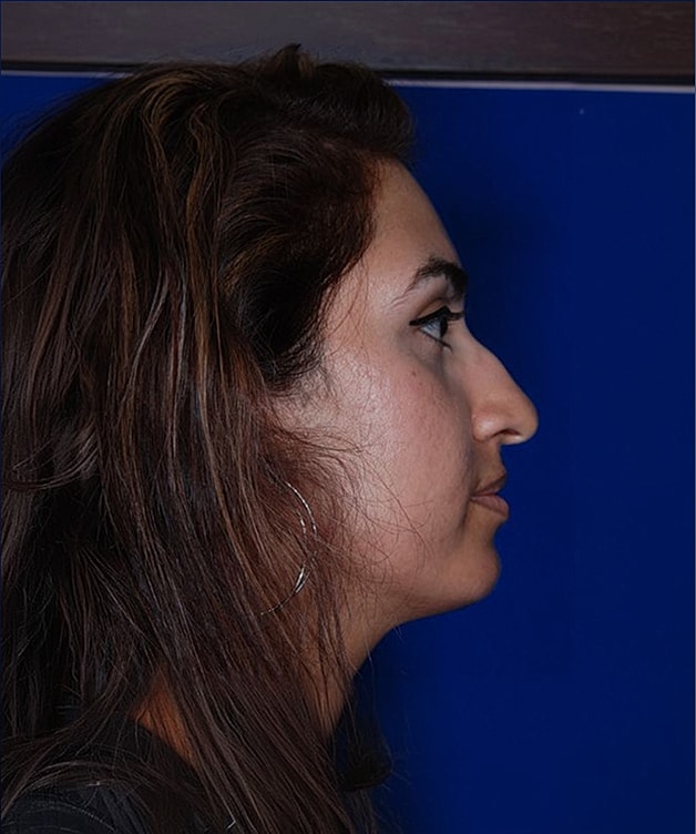 Profile of a woman against a blue background.