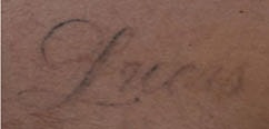 Tattoo Removal Before & After