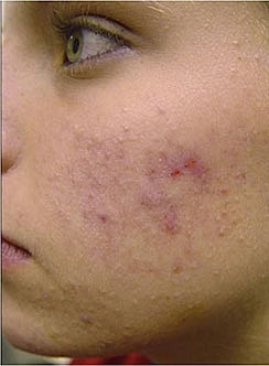 Vivace Before & After