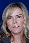 Facelift Before & After