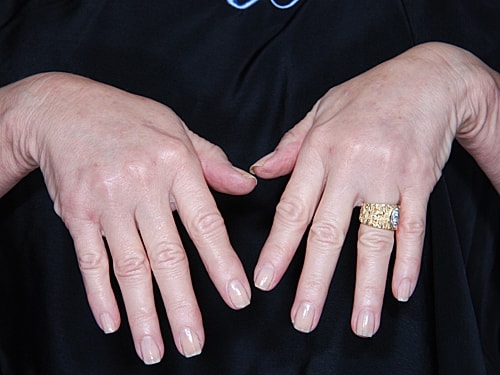 Hand Rejuvenation Before & After